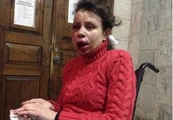 СМИ сообщают о жестоком избиении Татьяны Чорновил в Борисполе
