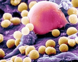 Жировые клетки защищают организм от бактерий