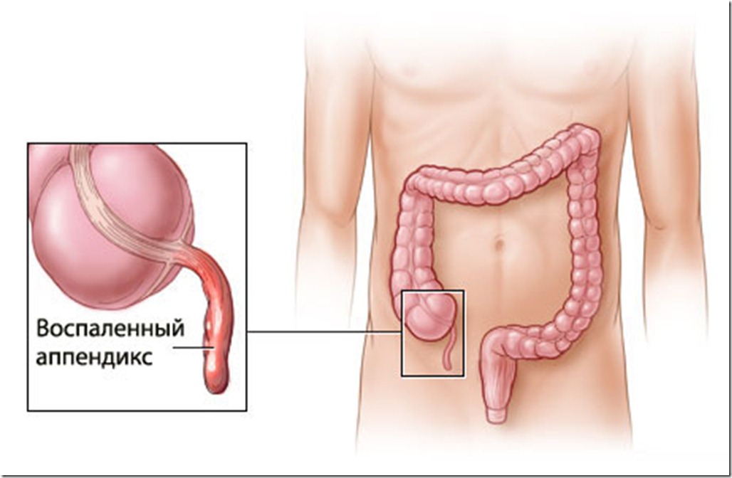 как похудеть не пользуясь диетами