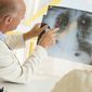 В Латвии научились диагностировать рак легких по дыханию пациентов