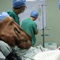 В Китае человеку-слону удалили огромную опухоль на лице 
