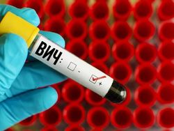 За год в России выявили 100 тысяч новых случаев инфицирования ВИЧ
