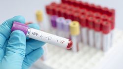 Вакцина против ВИЧ успешно прошла испытания