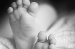 У родившихся на Донетчине сиамских близнецов, срослись сердца и печень