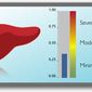 Fibrotest: инновационные диагностирования заболеваний печени - медики Израиля